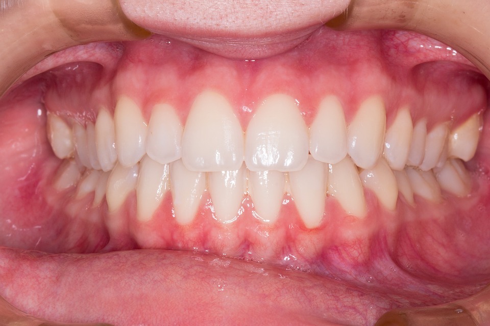 Mondhygiëne bij kinderen en volwassenen