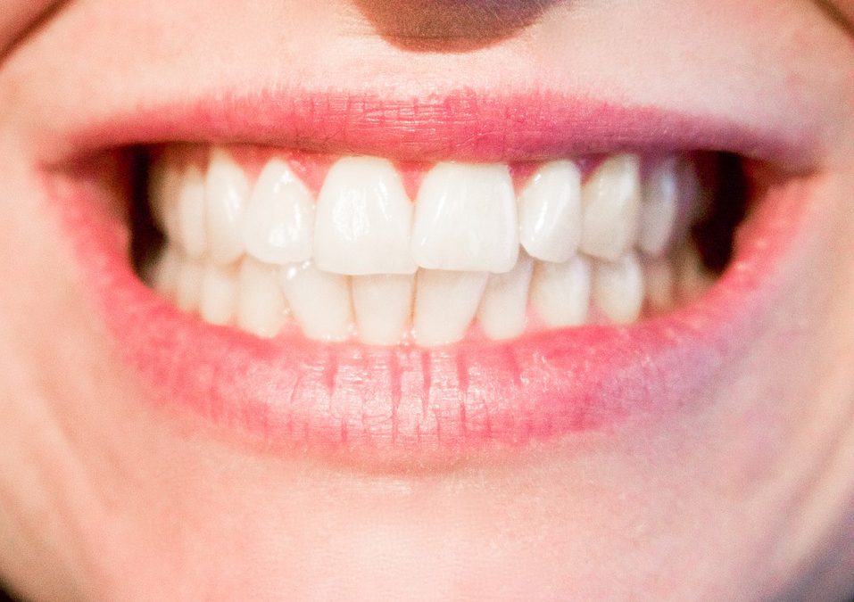 Voordelen van een goede mondhygiëne
